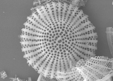 microscopic diatom